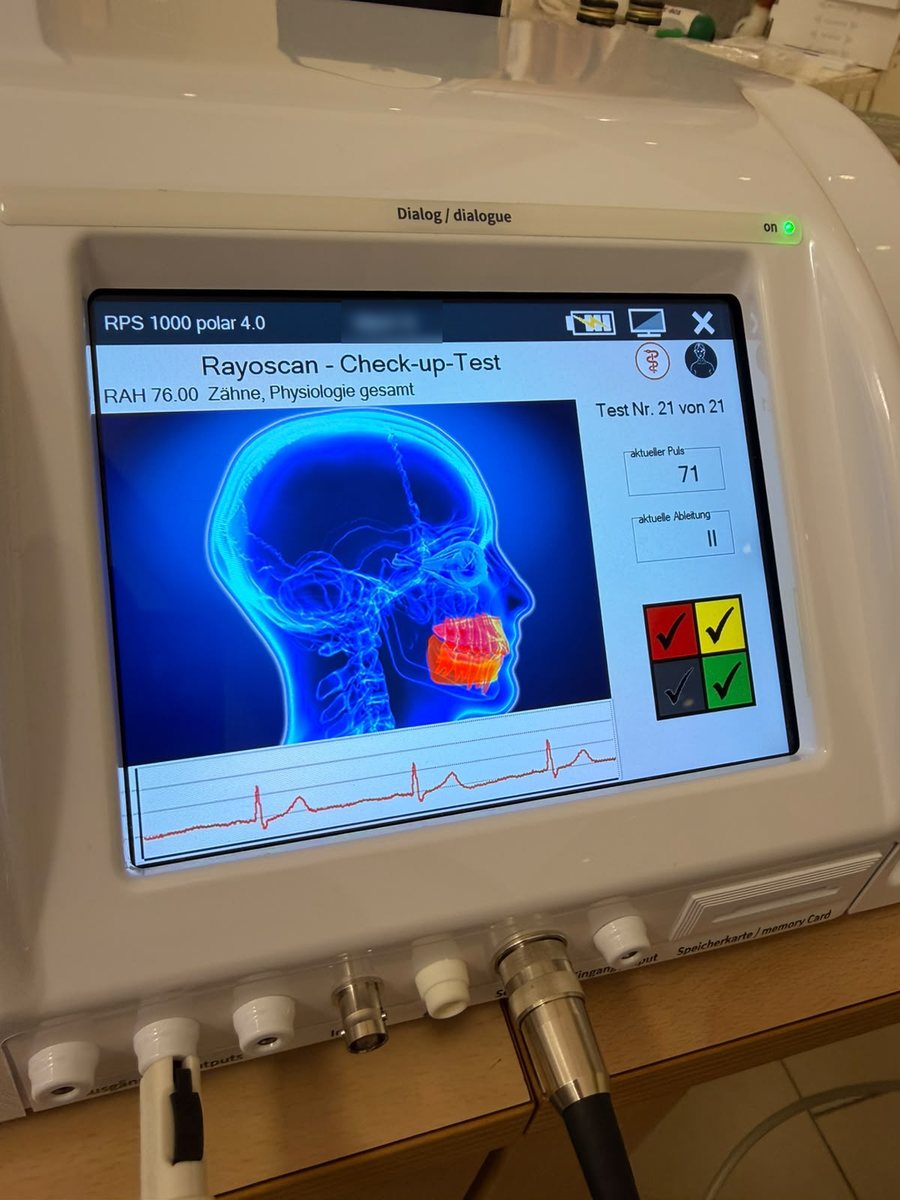Display des Rayocomp PS 1000 polar in der Praxis von Lisa Julia Wester-Ripp während einer Testung